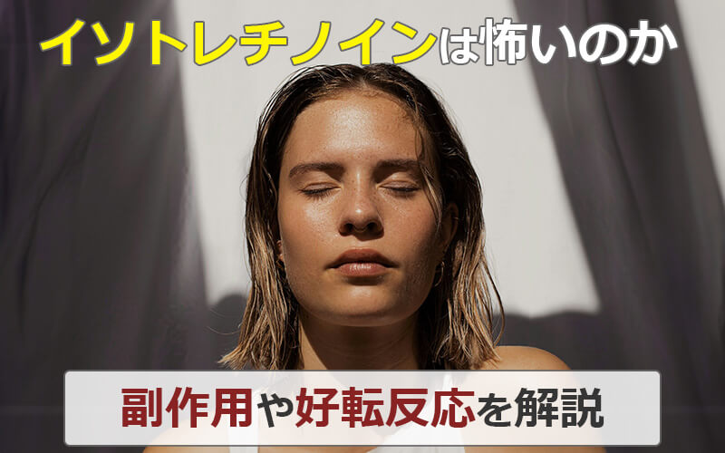 イソトレチノインは怖いのか|副作用や好転反応を解説