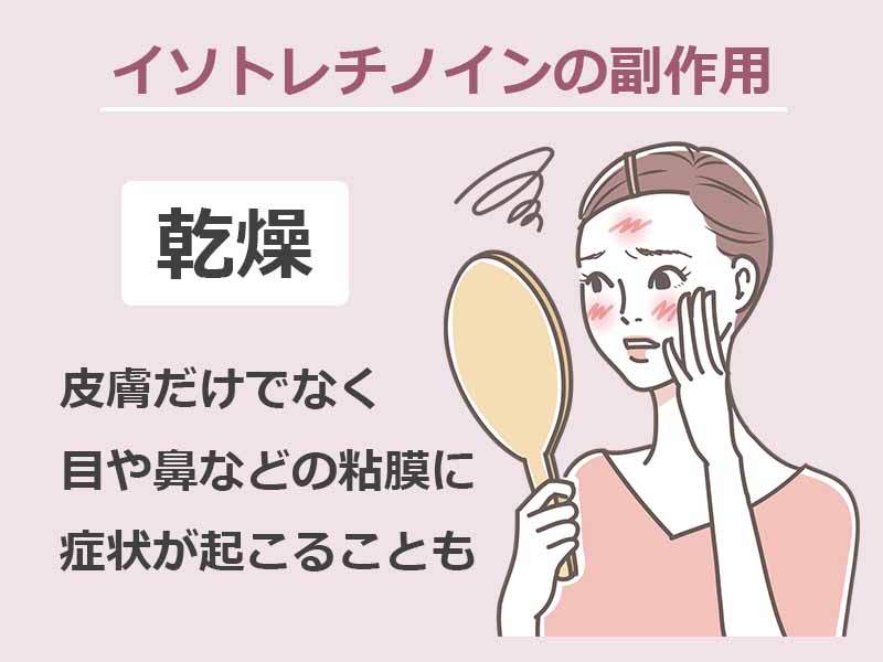 イソトレチノインの副作用 乾燥