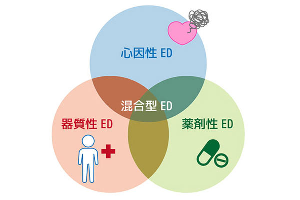 ED(勃起不全)の原因